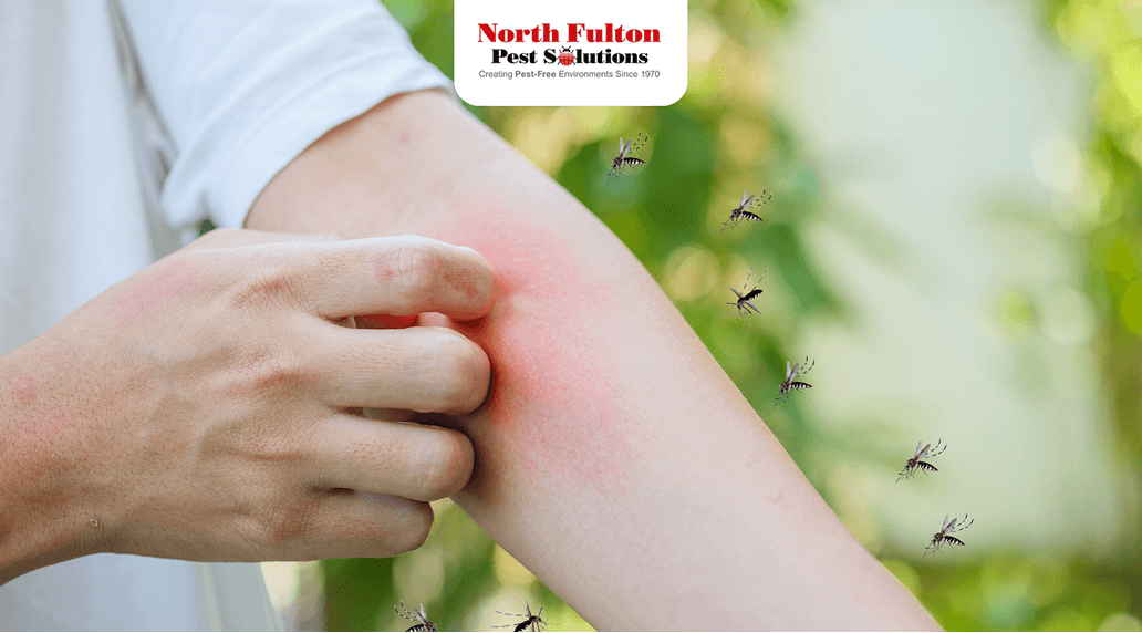 Are You an “Atlanta Mosquito Magnet”? 10 Fixes That Work